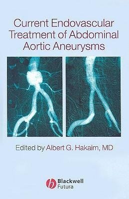 Current Endovascular Treatment