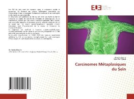 Carcinomes Métaplasiques du Sein