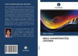 ORALE HAMARTOMATÖSE LÄSIONEN
