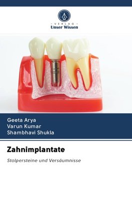 Zahnimplantate