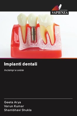 Impianti dentali