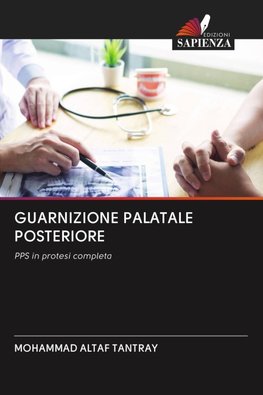 GUARNIZIONE PALATALE POSTERIORE