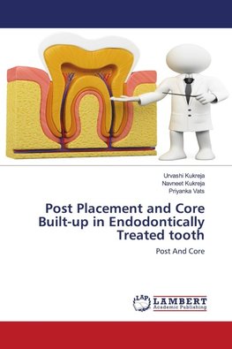 Post Placement and Core Built-up in Endodontically Treated tooth