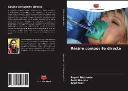 Résine composite directe