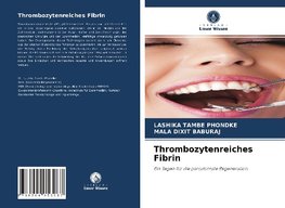 Thrombozytenreiches Fibrin