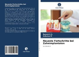 Neueste Fortschritte bei Zahnimplantaten