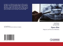 Open Bite