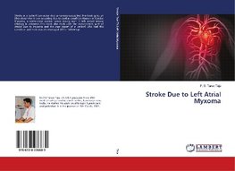 Stroke Due to Left Atrial Myxoma