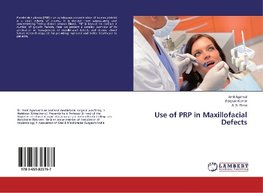 Use of PRP in Maxillofacial Defects