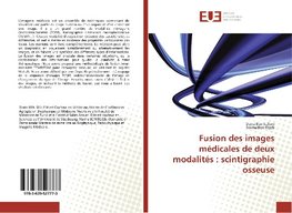 Fusion des images médicales de deux modalités : scintigraphie osseuse