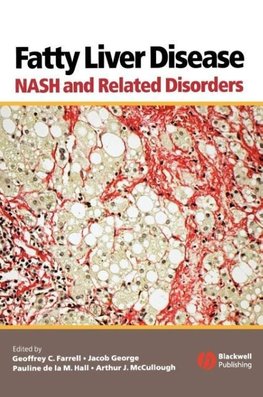 Fatty Liver Disease