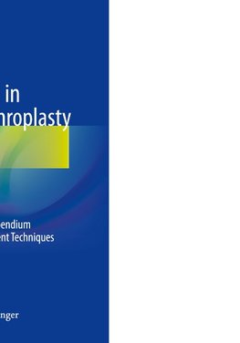 Complex Cases in Total Knee Arthroplasty