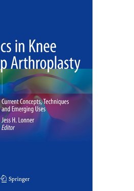 Robotics in Knee and Hip Arthroplasty
