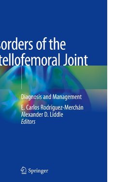 Disorders of the Patellofemoral Joint