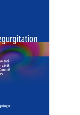 Aortic Regurgitation