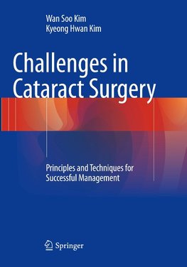 Challenges in Cataract Surgery