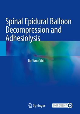 Spinal Epidural Balloon Decompression and Adhesiolysis