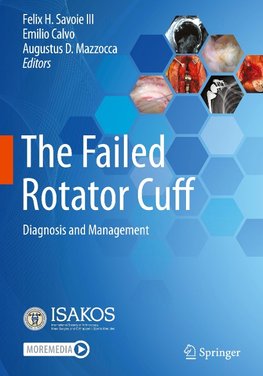 The Failed Rotator Cuff