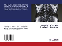 Essentials of CT scan imaging in Hematuria