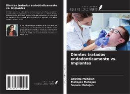 Dientes tratados endodónticamente vs. Implantes