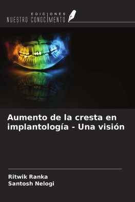 Aumento de la cresta en implantología - Una visión