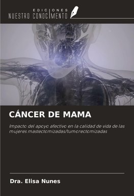 CÁNCER DE MAMA