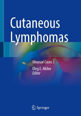 Cutaneous Lymphomas