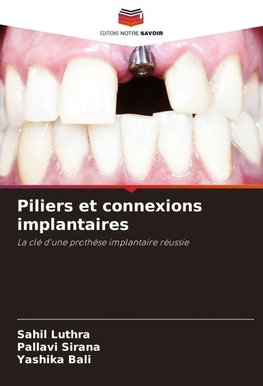 Piliers et connexions implantaires