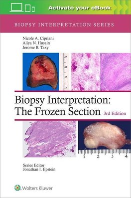 Biopsy Interpretation