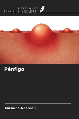 Pénfigo