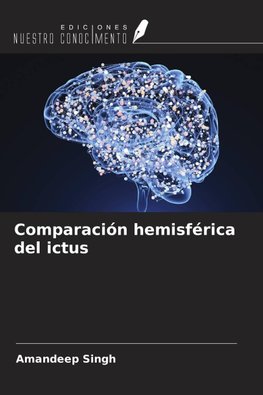 Comparación hemisférica del ictus