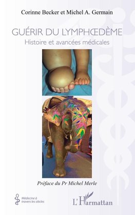 Guérir du lymphoedème