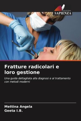 Fratture radicolari e loro gestione
