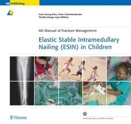 Elastic Stable Intramedullary Nailing (ESIN) in Children mit DVD