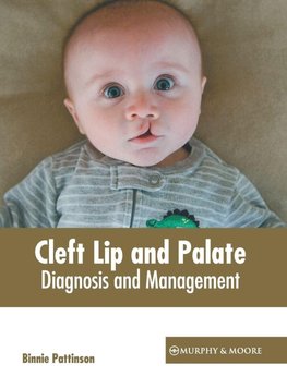 Cleft Lip and Palate