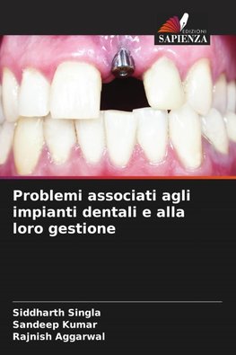 Problemi associati agli impianti dentali e alla loro gestione