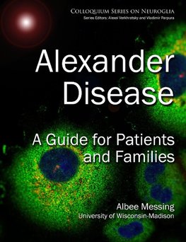 Alexander Disease