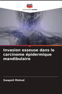 Invasion osseuse dans le carcinome épidermique mandibulaire