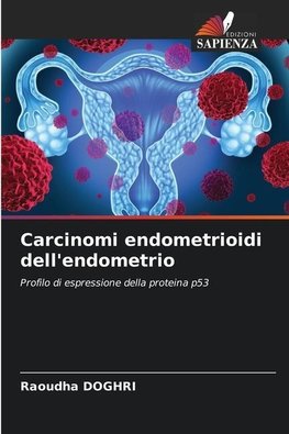 Carcinomi endometrioidi dell'endometrio