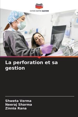 La perforation et sa gestion
