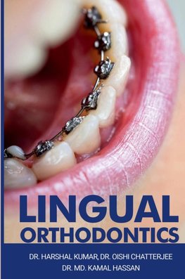 Lingual Orthodontics