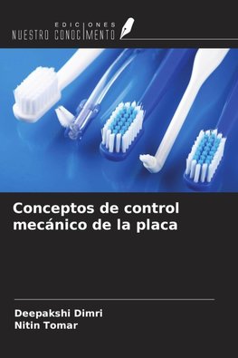 Conceptos de control mecánico de la placa