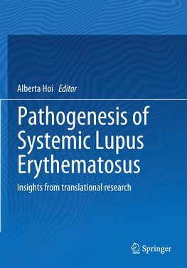 Pathogenesis of Systemic Lupus Erythematosus