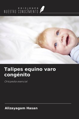 Talipes equino varo congénito