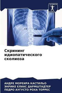 Skrining idiopaticheskogo skolioza