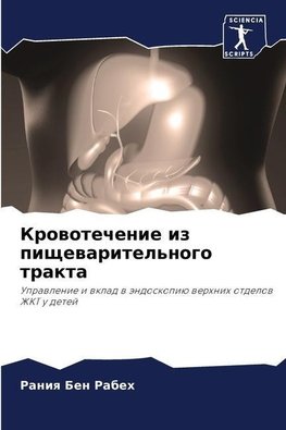 Krowotechenie iz pischewaritel'nogo trakta