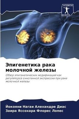 Jepigenetika raka molochnoj zhelezy