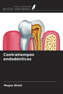 Contratiempos endodónticos