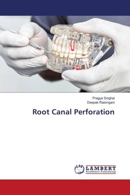 Root Canal Perforation