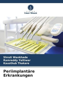 Periimplantäre Erkrankungen
